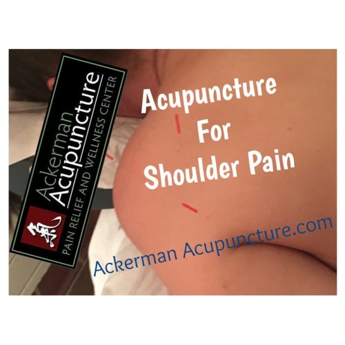 Is Your Shoulder Pain due to “Frozen Shoulder” and How Can Acupuncture Help (in Blaine, MN)?