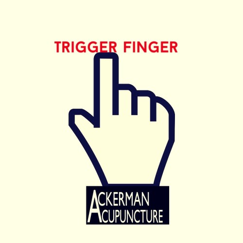 Don’t Get Stuck with Trigger Finger- Get Acupuncture (In Anoka)!