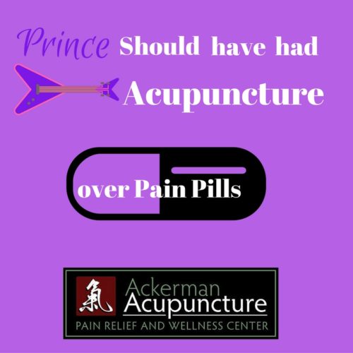 Prince Should Have Tried Acupuncture For Chronic Pain Instead of Opioids (near Ramsey, MN)!
